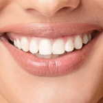 راهنمای جامع محصولات زیبایی و ترمیمی: از کامپوزیت تا بلیچینگ | رفیع دنتال